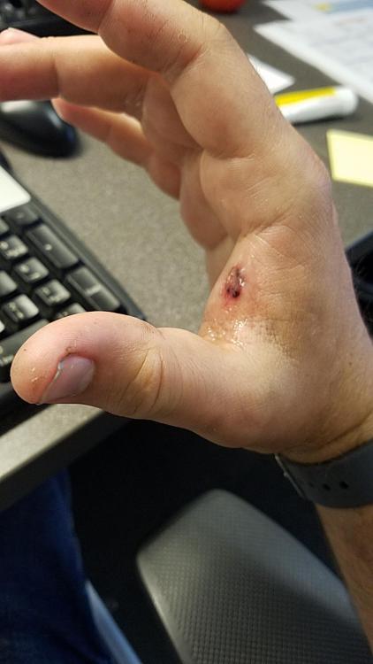 hand.jpg